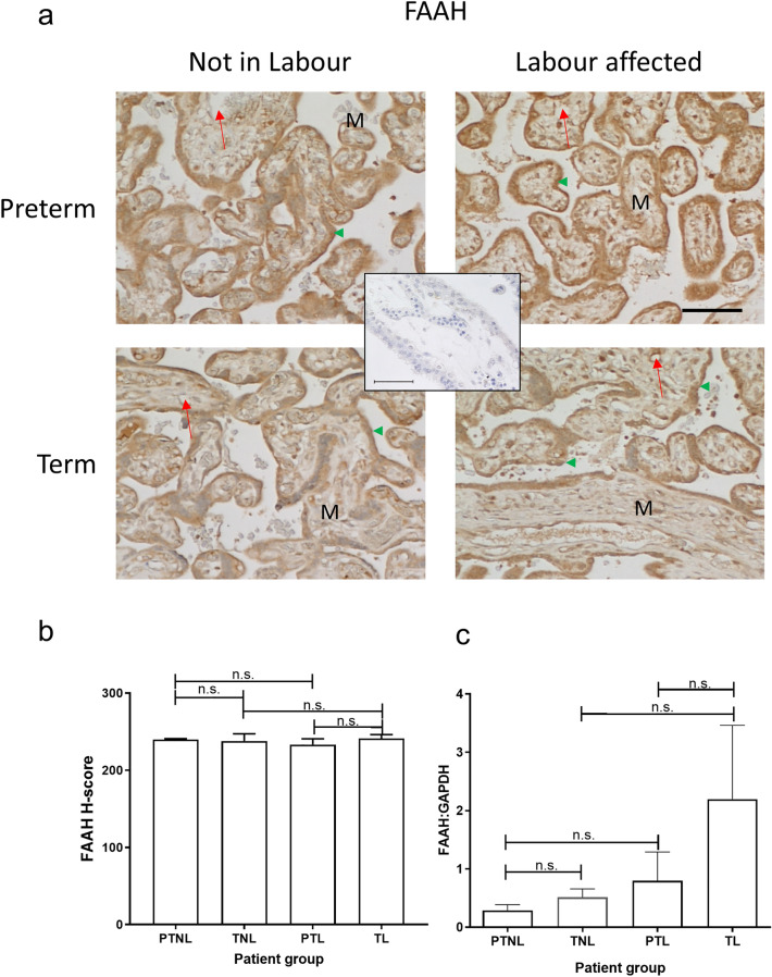 Effect of labour and prematurity on FAAH protein and transcript expression and levels. Representative photomicrographs of villous trophoblasts from ten images taken for each patient within each of the four patient groups (n = 6 samples per group) are shown in panel a. Images were obtained at 200× and 40× magnification as described in the legend to Fig. 2. Bar, 50 μm. Panel b shows the results of histomorphometric analyses of the 240 FAAH immunoreactivity images for the four different patient groups. Differences between groups were calculated using one-way ANOVA; n.s. non-significant. Panel c shows the levels of FAAH mRNA corrected for the levels of GAPDH. Data are presented as the mean ± SEM of six patient samples in each group, with each sample examined in triplicate. Differences in expression levels were determined using one-way ANOVA with Dunnett’s T3 multiple comparisons tests; p-values are shown for significant comparisons