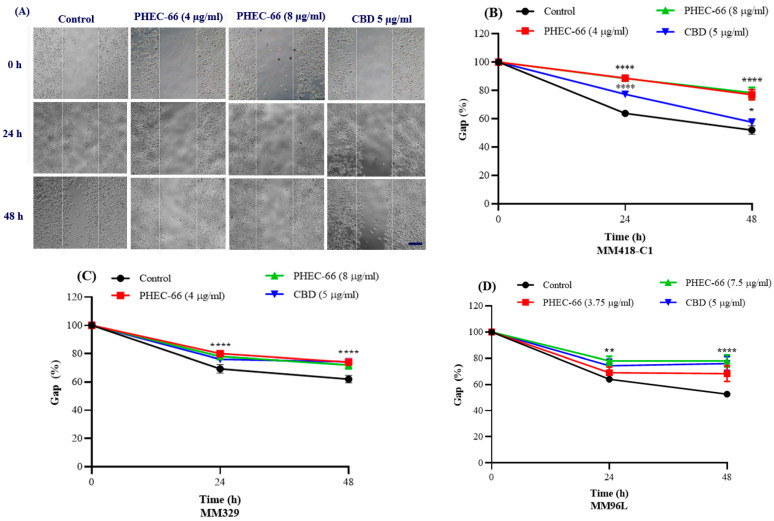 PHEC-66 and CBD reduces the motility of melanoma cells. A representative image of MM418-C1 gap closure over 48 h following PHEC-66 and CBD treatment (A). The effect of PHEC-66 (50% and 100% of their respective IC50 values) and CBD (equivalent to the amount present in 100% PHEC-66) treatment for 48 h on the migration of MM418-C1 (B), MM329 (C), and (D) MM96L cell lines (D). Error bars indicate ± SEM (n = 3). Asterisks indicate statistically significant differences between CBD-treated cells and PHEC-66 treated cells (* p = 0.05, ** p = 0.01, **** p < 0.0001 one-way ANOVA with Tukey’s multiple comparisons test). (Scale bar = 100 µm).