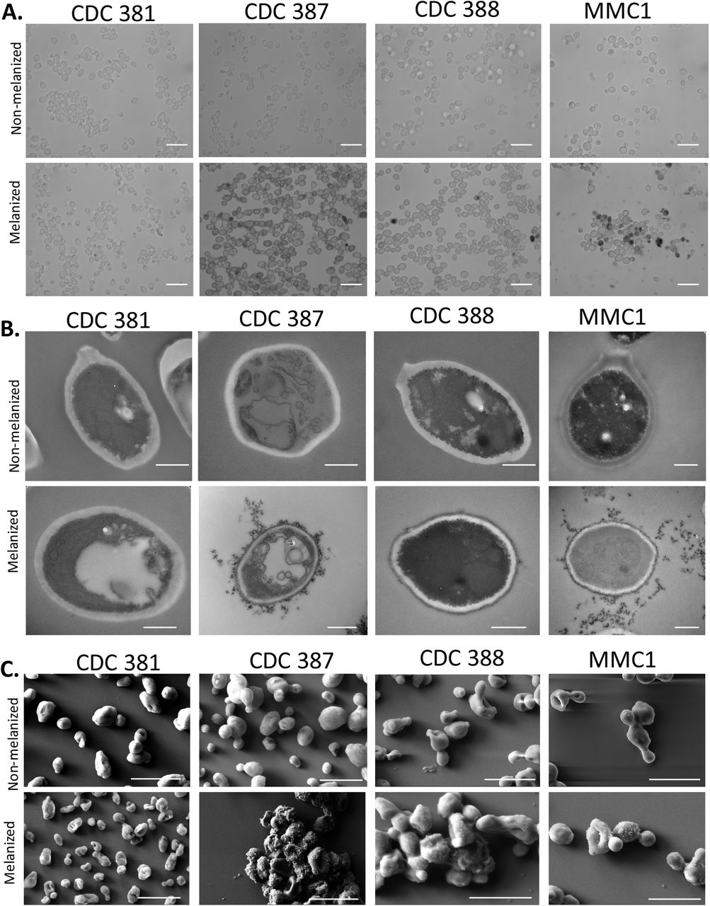 Melanin is primarily deposited on the cell wall surface.(A) Light Microscopy shows that the 387, 388, and MMC1 cells have darker color when grown in minimal media with L-DOPA, while there is little color change in the CDC 381 cell color. Some of the pigmented cells have dark pigmentation within the cell. CDC 387 in particular appears to have large pigmented extracellular structures. Scale bars represent 10 μm. Images representative of three biological replicates. (B) Transmission electron microscopy shows electron dense particles on the outside of only the 387, 388, and MMC1 cells grown in the presence of L-DOPA, which is indicative of melanin pigment. These dark particles are found on the external cell wall and in the extracellular space; they are especially visible in the CDC 387 and MMC1 micrographs. Scale bars represent 500 nm. (C) Similar external granule structures on the surface of CDC 387, 388, and MMC1 cells grown with L-DOPA can be seen in scanning electron micrographs. Scale bars represent 5 μm.
