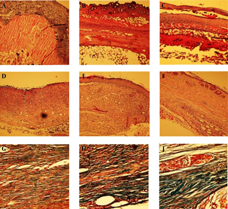 Effect of NF on Skin Repair in MiceA, SSD; B, Negative control; and C, NF at Day 4 (H and E). D, SSD; E, Negative control; and F, NF at Day 21 (H and E). G, SSD; H, Negative control; I, NF at dat 21 (Trichrome staining). Skin repair after burning was evaluated using histological analysis with H and E (100×) and Masson’s trichrome staining (400×). The NF group showed marked tissue re-epithelialization, granulation tissue formation, scattered inflammatory cell infiltration, and collagenization in the dermis and skin appendages. NF, new formula; SSD, silver sulfadiazine (as positive control).