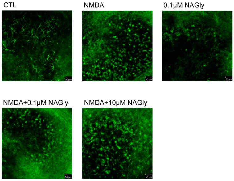 In green IB4-positive microglia are shown in the dentate gyrus of OHSC. CTL: In control medium microglia cells showed in dentate gyrus a ramified morphology with extensive branching of cytoplasmic processes. After NMDA (10 µM) lesion microglial cells become amoeboid and their number increased. Microglia displayed a ramified morphology after incubation with 0.1 µM NAGly alone. Treatment with NMDA and NAGly (0.1 µM, 10 µM) led to amoeboid morphology of microglial cells and an increase in their numbers. Qualitatively no obvious differences in the morphology of microglia was found when NAGly treated groups were compared to those without NAGly. Scale bar = 50 µm.