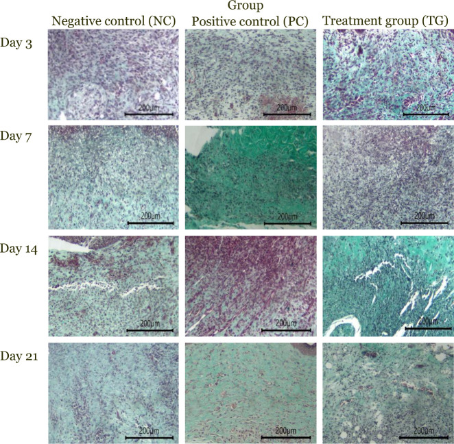 Histopathological evaluation of granulation tissue formation under 400× magnification revealed, on day 3, granulation was absent in all groups. By day 7, thin, scattered granulation fibers were observed. On day 14, granulation fibers increased, with the treatment group (TG) showing denser deposition than the positive control (PC) and negative control (NC) groups, though the fibers remained disorganized. By day 21, granulation tissue filled the wound gaps and became denser. All groups exhibited more mature Type I granulation on day 14 compared to day 7, with the TG group showing notably enhanced formation compared to the NC and PC groups.