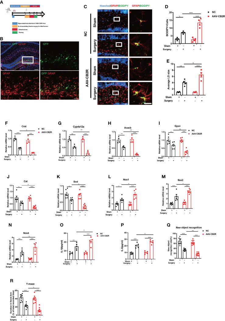 (A) Experimental protocol and timeline. Injection with the AAV virus in the hippocampus of mice 2 weeks before surgery; behavioral and biological testing 2 d after surgery. (B) Immunofluorescence staining of GFAP and AAV virus–GFP staining in the hippocampal DG brain region. (C–E) Immunofluorescence staining of GFAP and BODIPY staining in the hippocampal DG brain region; statistical data on BODIPY+ cells and the average LD size (means±SEM, n=4, scale bars=40 and 3 μm). (F–N) RT-qPCR results of the relative mRNA expression levels of Crat, Cyp4a12a, Acacb, Gpx4, Sod, Cat, and Nox1,2,4 in the hippocampus (means±SEM, Crat, Cyp4a12a, Acacb, n=4; Sod, Cat, and Nox1,2,4 n=6). (O, P) ELISA of serum IL-1β and IL-6 (n=5). (Q, R) New object recognition and Y-maze testing of mice in each group (means±SEM, n =10). * P < 0.05, ** P < 0.01, *** P < 0.001 compared with the corresponding group, as determined by two-way ANOVA, F (1, 12) BODIPY Cells Interaction=17.22; F (1, 12) LD size Interaction=7.598; F (1, 12) Crat Interaction=2.169;F (1, 12) Cyp4a12a Interaction=8.219; F (1, 12) Acacb Interaction=9.162;F (1, 20) Gpx4 Interaction=7.022;F (1, 20) Cat Interaction=3.355;F (1, 20) Sod Interaction=4.956;F (1, 20) Nox1 Interaction=6.025;F (1, 20) Nox2 Interaction=4.125;F (1, 20) Nox4 Interaction=4.494;F (1, 16)IL-1βInteraction=4.600;F (1, 16) IL-6 Interaction=3.384; F (1, 28) New object recognition Interaction=3.258;F (1, 28) Y-maze Interaction=2.318, followed by Tukey’s post hoc test.