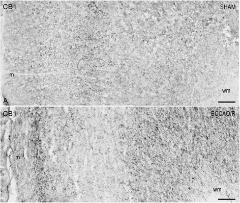 CB1-like immunoreactivity in the frontal cortex. Brain sections of sham-operated and BCCAO/R rats are shown in (a) and (b), respectively. Panels (a) and (b) are representative of observations carried out in 6 sham-operated and 6 BCCAO/R rats. Positive nervous structures are distributed throughout the cortical layers. m, molecular layer; wm, white matter. Scale bars: 50 μm