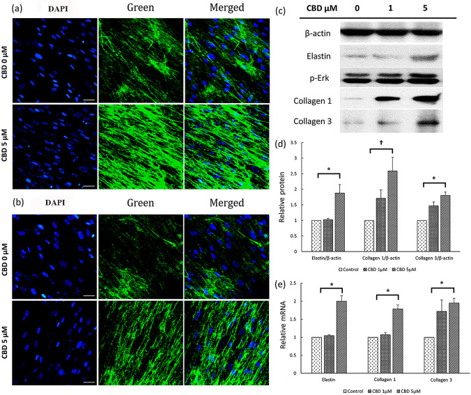 Changes in the expression of proteins related to scar formation induced by CBD. (a, b) Fibroblasts were treated with CBD at concentrations of 0 µM and 5 µM for a duration of 48 h. DAPI staining was performed to assess the impact of CBD treatment. Collagen 1 (a) and collagen 3 (b) expression were evaluated using DAPI staining (400×). All are at the same magnification (bar = 50 μm). (c) Western blot analysis confirmed changes in the expression of elastin, collagen 1, collagen 3, and p-Erk at CBD concentration of 1 µM or 5 µM. (d) Quantification of western blot bands for elastin/β-actin, collagen 1/β-actin, and collagen 3/β-actin was performed. (e) Quantitative real-time analysis confirmed the mRNA expression levels of elastin, collagen 1, and collagen 3. CBD, cannabidiol; DAPI, 4’,6-diamidino-2-phenylindole; p-ERK, phosphorylated ERK. *, P < 0.05; †, P < 0.00