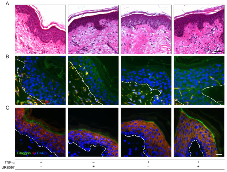 URB597 counteracts the EMT process triggered by TNF-α modulating E-cadherin localization and promoting keratinocyte differentiation. (A) Hematoxylin-and-eosin-stained sections from vehicle and TNF-α (20 ng/mL) stimulated ex vivo skin explants treated or not with URB597 (5 μM) for 4 days. Double immunofluorescence staining for E-cadherin and vimentin (B) and filaggrin and K1 (C) on ex vivo skin specimens treated as above. Nuclei are counterstained with DAPI and the basal membrane is outlined with a white dashed line. Scale bar: 50 μm (A), 20 μm (B,C).