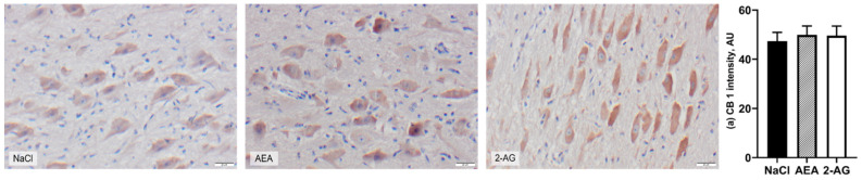 Representative images of DAB-stained CB1-expressing neurons in the periventricular nucleus (PVN) of cows after intraperitoneal administration with NaCl (n = 7), AEA (n = 7) or 2-AG (n = 6) for 9 days. CB1 immunoreactivity was visualized with DAB (arbitrary units, AU) and nuclei were stained with hemalaun (blue). Scale bar within images indicates 20 µm. CB1 intensities (a) are shown as LSM ± SE with F(2,15) = 0.15, p = 0.86 (ANOVA).
