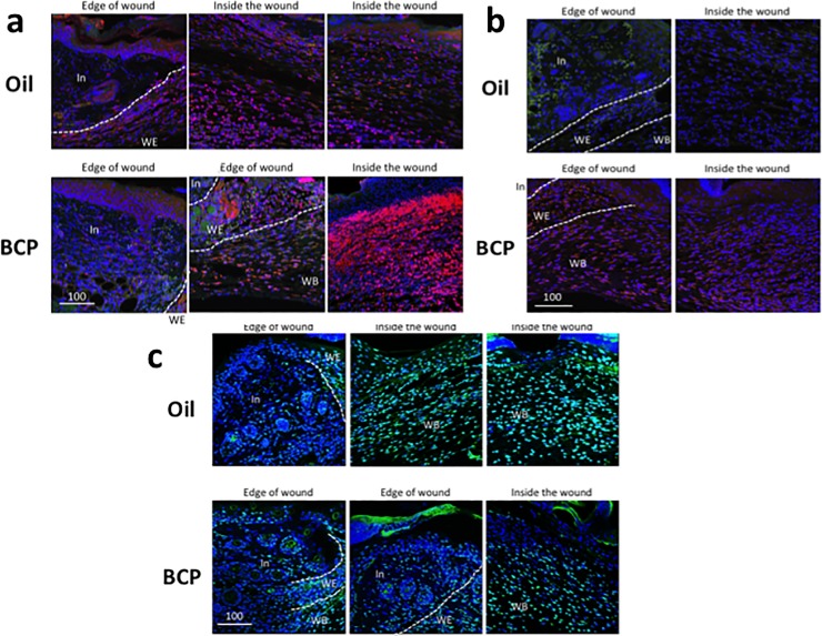 IL-1β, TNFα in the skin at the wound bed and close to the wound, and TUNEL staining of the skin at the wound bed and close to the wound.(a) IL-1β (red and purple) expression in the BCP and the Oil group. Blue color as well as purple color is Draq 5+ cells. Green is autofluorescence. (b) TNFα expression (red and purple) expression in the BCP and Oil group. Blue color as well as purple color is Draq 5+ cells. Green is autofluorescence. (c) TUNEL staining with double staining with Draq 5. Green and light blue is TUNEL+ cells. Blue and light blue is Draq5+ cells. Scale bars are μm.