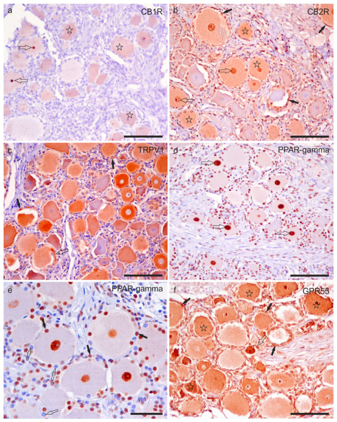 Photomicrographs of formalin-fixed paraffin embedded sections of equine trigeminal ganglion showing immunoreactivity for the cannabinoid receptor type 1 (CB1R) (a) and type 2 (CB2R) (b), transient receptor potential vanilloid 1 (TRPV1) (c), perossisome proliferator-activated receptor gamma (PPARγ) (d,e), and G-protein coupled receptor 55 (GPR55) (f). (a) Stars indicate sensory neurons showing faint CB1R immunoreactivity. The open arrows indicate two strongly immunoreactive nucleoli for the CB1R. (b) Stars indicate sensory neurons which showed moderate CB2R immunoreactivity. The open arrows indicate the neuronal nuclei expressing strong CB2R immunoreactivity. Black arrows show satellite glial cells surrounding the sensory neurons, showing faint-to-moderate CB2R immunoreactivity. (c) A large proportion of sensory neurons expressed moderate-to-strong TRPV1 immunoreactivity. Axon hillocks (open arrow) were also positive for TRPV1, as well as satellite glial cells (black arrows). (d) The open arrows indicate the nuclei of the sensory neurons, showing strong PPARγ immunoreactivity. (e) Not all nuclei of satellite glial cells showed PPARγ immunoreactivity; some were strongly reactive (black arrows), whereas some appeared negative (open arrows). (f) Stars indicate the cell body cytoplasm of sensory neurons with moderate-to-strong GPR55 immunoreactivity. The open arrows indicate the axon hillock of a small neuron which expressed strong GPR55 immunoreactivity. The black arrows indicate some satellite glial cells which were positive for GPR55. Bars: (a–d,f): 100 µm; (e): 50 µm.