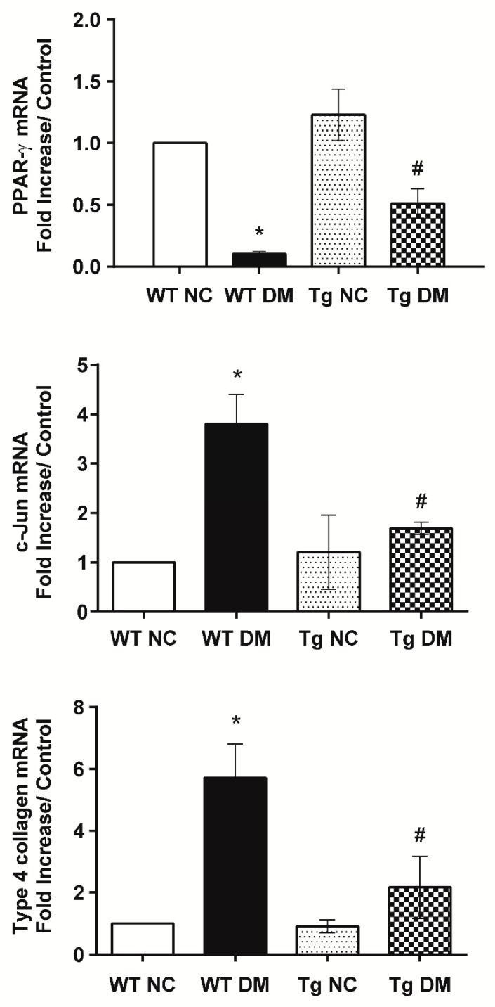 Reduction of c-Jun and type 4 collagen, but restoration of peroxisome proliferator-activated receptor-γ (PPAR-γ) mRNA levels in miR-29a transgenic mice after induction of diabetes. The mRNA expression levels of c-Jun, type 4 collagen, and PPAR-γ, normalized to that of β-actin, in microdissected glomeruli of study animals were quantified by qRT-PCR (n = 6). The symbol * indicates significant difference vs. the WT NC group (p < 0.05); the symbol # indicates significant difference vs. the WT DM group (p < 0.05).