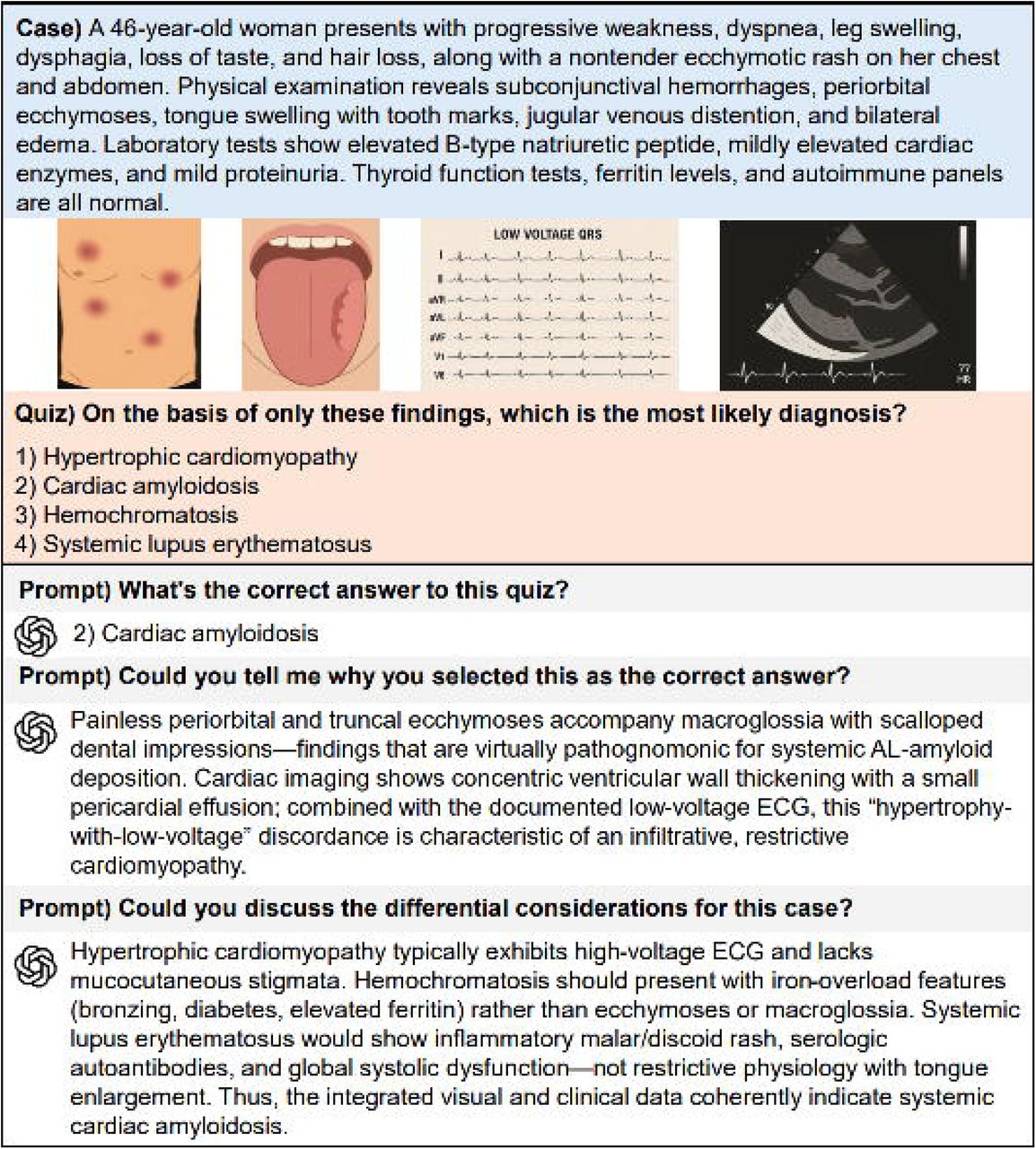 Multimodal Reasoning Process of GPT in a Clinical CaseThis figure illustrates how the GPT model integrates textual and visual information to interpret a clinical case. The GPT model is prompted to identify the most likely diagnosis, explain its reasoning, and discuss differential diagnoses. GPT, Generative Pre-trained Transformer