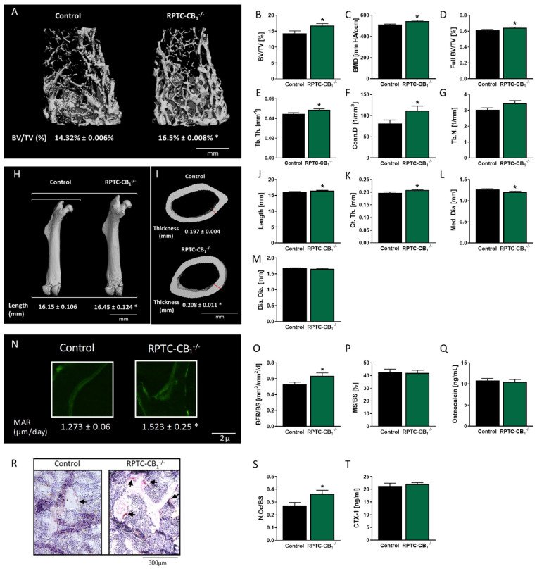 Main endocannabinoid receptor (CB1R) in renal proximal tubule cells (RPTCs) modulates bone mass and function under normoglycemic conditions. 3D images of the distal femoral metaphysis of RPTC-CB1−/− mice and their littermate wild-type (WT) controls with median bone volume density (BV/TV) values (A,B), bone mineral density (BMD; C), full bone BV/TV (D), trabecular thickness (Tb.Th; E), connectivity density (Conn.D; F), and trabecular number (Tb.N; G). 3D images of the femora of RPTC-CB1−/− mice and their littermate WT controls with median values of length for each group (Length; H,J). 3D images of the femoral mid-diaphysis of mice with median values of cortical thickness (Ct.Th) for each group (I,K), medullary diameter (Med.Dia; L), and diaphyseal diameter (Dia.Dia; M). Histomorphometric analysis of the bone formation parameters. Representative images of calcein-labeled mineralized fronts with mineral apposition rate (MAR) values (N), the bone formation rate (BFR/BS; O), mineralizing surface (MS/BS; P), and serum osteocalcin levels (Q). Images of TRAP+ osteoclasts (R), the number of osteoclasts per trabecular surface area (N.Oc/BS; S), and the serum levels of CTX-1 (T). Data represent the mean ± SEM from 10–14 animals per group, * p < 0.05 relative to the corresponding control group.