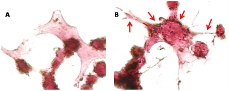 Immunocytochemical analysis of NSC-34 cells. Control cells (A) and 10 µM CBNR treated cells (B) were immunoprofiled for β-actin. Objective: 100×. Red arrows indicate positive staining for β-actin.