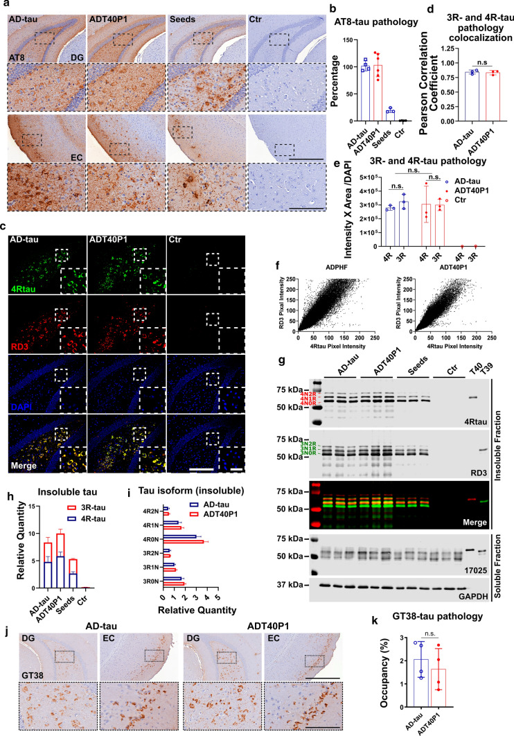 ADT40P1 and AD-tau recruit 3R and 4R tau isoforms in vivo. a IHC of 6hTau mouse brains injected with AD-tau or ADT40P1 at 3-month post-injection; Seed controls were used to demonstrate the amount of tau pathology induced by AD-tau in the ADT40P1 reaction mixture; controls (Ctr) show noninjected age-matched 6hTau mice; AT8 was used to visualize hypophosphorylated tau aggregates; representative images show the ipsilateral dentate gyrus (DG) and entorhinal cortex (EC); Scale bar = 500 µm and 125 µm (inset). b Quantification of AT8 tau pathology from a; AD-tau was set as 100%; n.s. nonsignificant AD-tau vs ADT40P1; one-way ANOVA followed by Tukey post hoc test; n ≥ 3. c IF of sections of 6hTau mouse brains injected with AD-tau or ADT40P1 in the hippocampus at 3-month post-injection time; Brain sections were costained for 3R- (RD3) and 4R-tau (4Rtau) isoforms; Scale bar = 200 µm and 50 µm (inset). d Colocalization of 3R- and 4R-tau immunoreactivity from c; n.s. nonsignificant; unpaired t test; n = 3. e Quantification of 3R- and 4R-tau pathology from c; n.s. nonsignificant; two-way ANOVA followed by Tukey post hoc test; n = 3. f Scatter plot of 3R- and 4R-tau positive signals from c. g Immunoblots of Triton-soluble and sarkosyl-insoluble fractions of ADT40P1- and AD-tau-injected 6hTau mouse brains; blots were probed with RD3 and 4Rtau antibodies for tau isoforms, K9JA probed for total tau, and GAPDH was used as an internal control for loading error; T39 = recombinant 2N3R tau. h Quantification of insoluble 3R- and 4R tau from g; n = 3. l Quantification of each isoform of tau from g; n = 3. j IHC of 6hTau mouse brains injected with AD-tau or ADT40P1 at 3-month post-injection; AD-tau pathology was visualized by the conformational antibody GT38. k Quantification of GT38-positive tau pathology from j; n = 4; n.s. nonsignificant AD-tau vs ADT40P1; unpaired t test