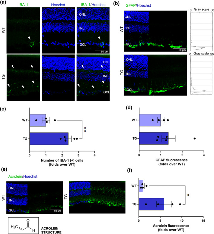 Analysis of gliosis. (a) Representative confocal images of WT and TG retinal cryosections immunostained with anti‐IBA‐1 to identify microglia cells. The white arrows indicate the IBA‐1 positive cells. Scale bar: 50 μm. (b) Representative confocal images of WT and TG retinal cryosections immunostained with anti‐GFAP to identify astrocytes and Müller cells reactivity, with corresponding plot profile graphs showing GFAP fluorescence throughout the retinal layers. Scale bar: 50 μm. (c) Quantification of IBA‐1 (+) cells counted on retinal cryosections of all experimental groups. Data are shown as mean ± SEM. The black dots indicate individual sample values (n = 4–5). (d) Quantification of GFAP fluorescence intensity on retinal cryosections of all experimental groups. Data are shown as mean ± SEM. The black dots indicate individual sample values(n = 4–5). (e) Representative confocal images of WT and TG retinal cryosections immunostained with anti‐Acrolein to investigate oxidative stress. The black box highlights the Acrolein chemical structure. Scale bar: 50 μm. (e) Quantification of Acrolein fluorescence intensity on retinal cryosections of all experimental groups. Data are shown as mean ± SEM. The black dots indicate individual sample values. Scale bar: 50 μm. Details of the statistics are reported in Table S1. For abbreviations see the abbreviations list.