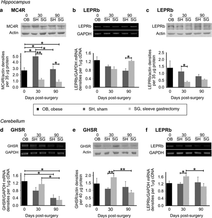 Energy homeostasis-related receptors exhibit differential expression levels in extra-hypothalamic areas after SG. In the hippocampus of SG animals a decrease in (a) MC4R protein levels were documented throughout the study period. In the same brain area, (b) LEPRb mRNA was solely increased in SG relative to sham-operated animals at 90 days post interventions, whereas (c) LEPRb protein levels reduced at 30 days post SG. In the cerebellum, a trend towards increased (d) GHSR message at 30 days post SG resulted in a significant increase at (e) protein levels of GHSR. In the long term, GHSR mRNA levels decreased in the SG group as compared with the levels of SG animals 60 days earlier. This decrease in message produced a decrease in GHSR protein levels between the SG animal groups. (f) The mRNA of LEPRb in the cerebellum increased only in the SG group, as opposed to sham, at 30 days post surgeries. Representative images of RT-PCR and WB are illustrated on top of the respective graphs. The expression levels of the housekeeping markers GAPDH and actin were used to normalize the genes of interest expression levels for RT-PCR and WB, respectively. n=4–6 animals per group; *P< 0.05 and **P< 0.01.