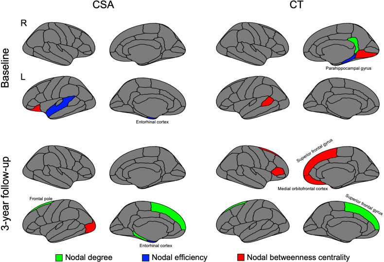 Group differences in nodal network metrics (nodal degree, nodal efficiency, and nodal betweenness centrality) of structural covariance networks based on cortical surface area and cortical thickness at baseline and 3-year follow-up.Regions that showed significant differences in AUC in the range from 6% to 40% network sparsity in nodal degree, nodal efficiency, and nodal betweenness centrality between groups were colored (P < 0.05, false discovery rate corrected). The green color represented regions that have altered nodal degrees in young adults with HCU. The blue color denoted regions that have altered nodal efficiency in young adults with HCU. The red color represented regions that have altered nodal betweenness centrality in young adults with HCU. This graph was plotted using the R and RStudio with both ggplot2 and ggseg packages.