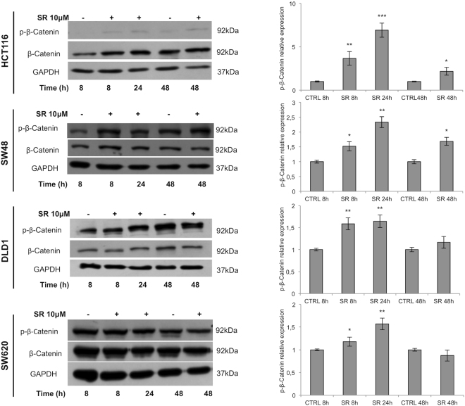 β-Catenin modulation in CRC cell lines. Representative western blot analysis of β-Catenin (total and phosphorylated form) expression in CRC cells treated with SR141716 (SR, 10 μM). The histograms represent the densitometric analyses of phospho-β-Catenin expressed as fold change of the total β-Catenin amount and normalized versus GAPDH (mean ± SD; unpaired two tailed Student’s t-test *p < 0.05, **p < 0.01 and ***p < 0.005). Cropped blots from full-length gels are displayed in left panel.