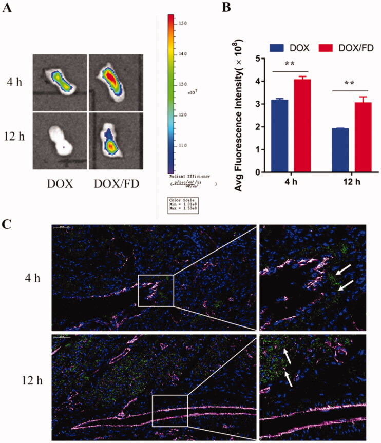 In vivo inflammation-targeting ability of fucoidan–deoxycholic acid (FD) nanomicelles after intravenous injection via the tail vein. (A) Fluorescence images of the tongue were obtained using an in vivo imaging spectrum system. (B) Semi-quantitative analysis of fluorescence images (n = 3). Data are shown as mean ± SD. (C) Immunofluorescence images of the tongue after administration of DOX/FD nanomicelles (blue, nucleus; green, DOX/FD nanomicelles; purple, blood vessels). DOX: doxorubicin. Scale bar, 50 μm.