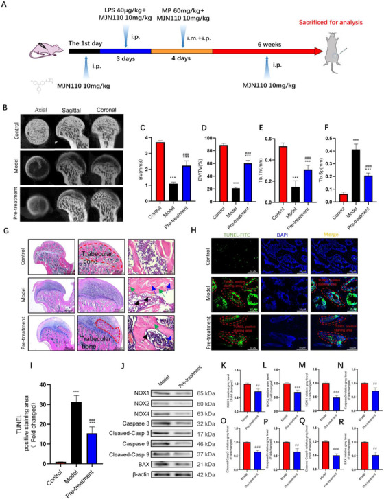 Pre‐treatment with monoacylglycerol lipase (MAGL) inhibitor alleviates GC‐induced osteonecrosis of the femoral head (ONFH). (A) The timeline of the GC‐induced ONFH model and administration of MJN110 in vivo. (B) Images of micro‐computed tomography (Micro‐CT). (C) Bone volume (BV). (D) Bone volume fraction (BV/TV). (E) Trabecular thickness (Tb.Th). (F) Trabecular spacing (Tb.Sp). (G) Hematoxylin and eosin (H&E) staining. (H) TUNEL staining of bone tissues. (I) Quantitative analysis of the area of TUNEL‐positive stain in (H). (J–R) The protein expression level of NADPH oxidative isozymes, apoptosis‐related proteins, and MAGL in bone tissues between model and pretreatment groups (n = 5, mean ± SD; *p < 0.05; **p < 0.01; ***p < 0.005 versus control group; #p < 0.05; ##p< 0.01; ###p < 0.005 versus MP group). Green arrows show nuclear pyknosis, blue arrows show empty osteocyte lacunae, and black arrows show fat droplets. All these studies were performed at least three biological replicates
