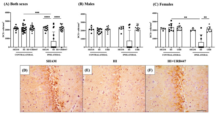 Effect of HI and URB447 on neurogenesis revealed by DCX+ cell counts. Data analysis was first performed in both sexes together and then in males and females separately. Graphs show DCX+ cells per mm2 in both sexes (A), males (B) and females (C). ** p < 0.01; *** p < 0.001; **** p < 0.0001 vs. HI. Images show representative photographs of the DCX expression in the SGZ of the ipsilateral hippocampi from sham (D), HI- (E) and HI+URB447-treated (F) animals. DCX+ cells appear marked in dark brown. All images were taken at 40× magnification. Scale bar: 50 μm.
