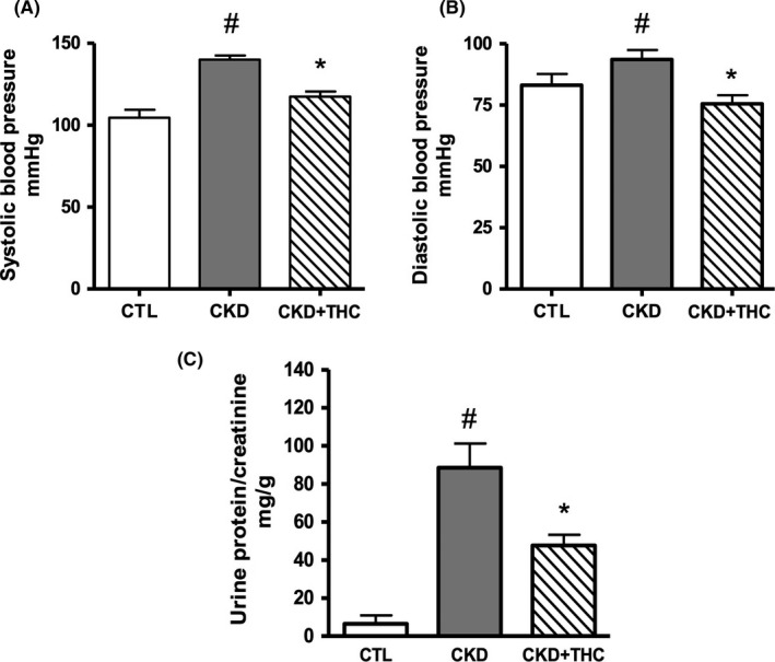 Blood pressure and proteinuria were decreased with tetrahydrocurcumin (THC) therapy. Systolic blood pressure (A) and diastolic blood pressure (B) were increased in CKD rats, and decreased with THC therapy. Proteinuria as assessed by urine protein/creatinine ratio (C) was significantly elevated in 5/6 nephrectomized CKD animals, and was significantly decreased with THC therapy. Data shown as mean ± SEM. # P < .05 vs CTL; *P < .05 vs CKD
