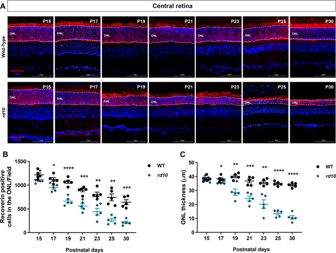 Comparison between strains demonstrated onset of photoreceptor in retinal center at P17 in rd10 mice. Histological sections of the retina’s central area immunostained for recoverin obtained from WT and rd10 animals. A Photomicrographs compare photoreceptor cells (red) at different postnatal ages (15, 17, 19, 21, 23, 25 and 30), and ONL thickness (white dashed lines). Nuclei were counterstained with DAPI (blue). B Analysis of central areas demonstrated loss of photoreceptors cells at P17, with a center-periphery pattern. Reduction in photoreceptor numbers continues until P30 in rd10 animals. Black circles represent WT animals and blue diamonds rd10. C In the central retina, ONL thinning is present at P17, following the same pattern of photoreceptor decrease. ONL—Outer nuclear layer. Calibration bar = 50 μm. Retinal field = 120 μm. Results represent the mean ± SEM of five independent experiments. Each age was analyzed independently using an unpaired Student’s t-test with Welch’s correction. *p < 0.05; **p < 0.01; ***p < 0.001; ****p < 0.0001