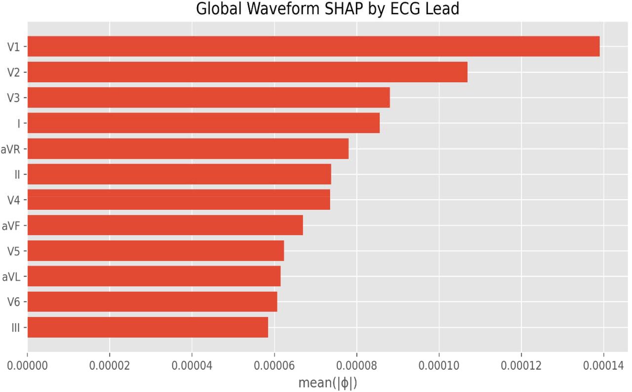 Global Waveform SHAP by ECG Lead