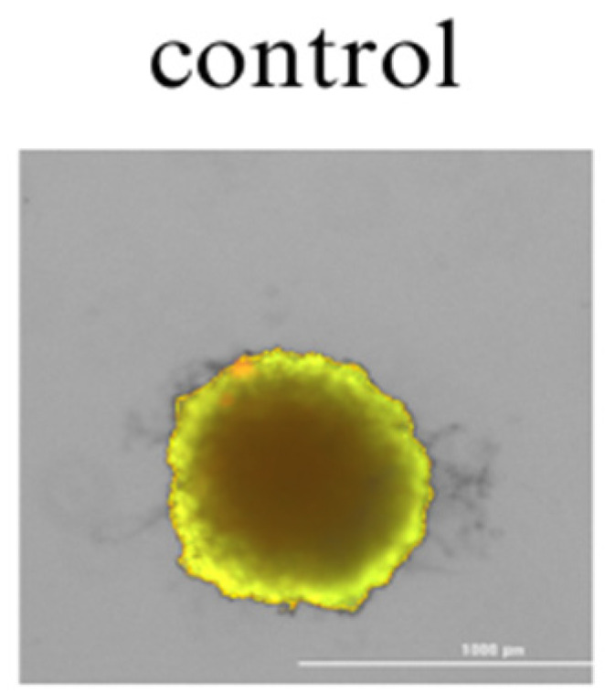 Spheroid 3D culture of colon cancer cells after 48 h of incubation with the solvent (DMEM F/12 medium) control culture (colon cancer cells incubated without the addition of cannabinoids). The scale bar is 1000 µm.