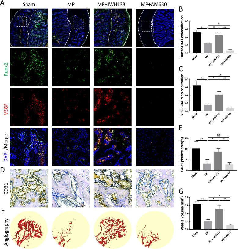 CB2 maintained the vascularization of the femoral head in vivo.A–C Immunofluorescence, green (Runx2), red (VEGF), and blue (nuclei). D, E Immunohistochemical staining and quantitative analysis of CD31. F, G Angiography images of femoral heads analyzed with micro-CT (n = 10 per group, data are shown as mean ± SD, *p < 0.05; **p < 0.01; ns, not significant).