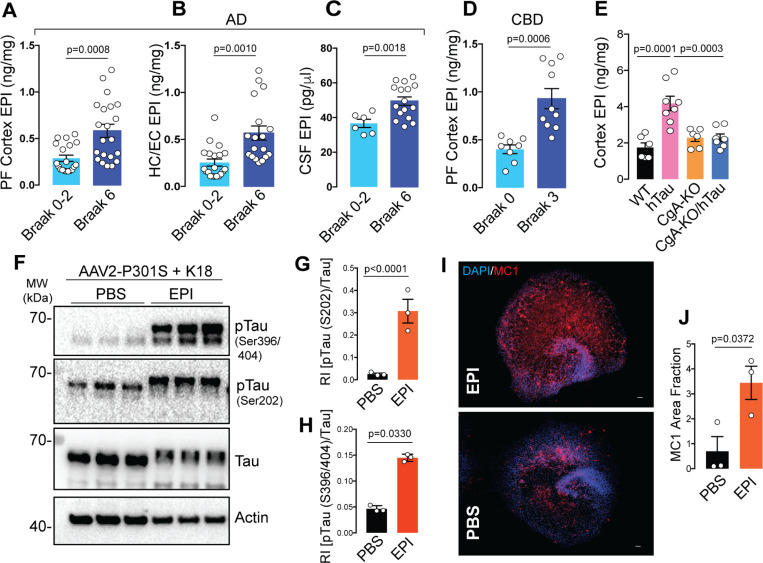 Elevated Epinephrine (EPI) levels in AD, CBD and hTau transgenic mice samples increases tauopathy in OTSCA. Quantification of epinephrine (EPI) levels in the Pre-frontal (PF) cortex of AD patients from Braak stage 0–2 (n=19) and Braak stage 6 (n=21). P-value was calculated using Unpaired two-tailed T-test with Welch’s correction, t=3.748, df=28.57.B. Quantification of EPI levels in the hippocampus/Entorhinal (HC/EC) cortex of AD patients from Braak stage 0–2 (n=20) and Braak stage 6 (n=18). P-value was calculated using Unpaired two-tailed T-test with Welch’s correction, t=3.726, df=24.85.C. Quantification of EPI levels in the CSF of AD patients from Braak stage 0–2 (n=6) and Braak stage 6 (n=16). P-value was calculated using Unpaired two-tailed T-test with Welch’s correction, t=3.764, df=15.17.D. Quantification of EPI levels in the Pre-frontal (PF) cortex of CBD patients from Braak stage 0 (n=8) and Braak stage 3 (n=10) stages. P-value was calculated using Unpaired two-tailed T-test with Welch’s correction, t=4.622, df=12.17.E. Quantification of EPI levels in the cortex of 9-months old mice WT (n=6), hTau (n=8), CgA-KO (n=6), and CgA-KO/hTau (n=7). P-value was calculated using One-way Anova (F3, 23=1.545, P=0.2298) Dunnett’s multiple comparison test.F. WB showing pTau, total tau and actin (loading control) in hippocampus OTSC lysates upon EPI treatment.G. Quantification of WB of Tau phosphorylation at S202 relative to total tau (n=3). P-value was calculated using Unpaired two-tailed T-test with Welch’s correction, t=18.32, df=3.944.H. Quantification of WB of Tau phosphorylation at S396/S404 relative to total tau (n=3). P-value was calculated using Unpaired two-tailed T-test with Welch’s correction, t=5.292, df=2.025.I. Representative IF images showing MC1+ Tau aggregates in hippocampus OTSC treated with EPI (top) or PBS control (bottom). Scale bar = 100 mm.J. Image J quantification of MC1+ fraction in EPI (n=3) and PBS (n=3) treated hippocampus OTSC. P-value was calculated using Unpaired two-tailed T-test with Welch’s correction, t=3.095, df=3.938.