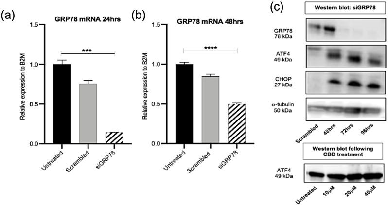 GRP78 knockdown in Panc03.27 cells does not affect the ATF/CHOP arm of the UPR pathway. (a) and (b) qPCR for GRP78 mRNA following transfection with 5 nM siGRP78 for 24 and 48 h. (c) Western blot (s) of housekeeping gene, alpha-tubulin, GRP78, ATF4 and CHOP following siRNA treatment and below plot represents ATF4 following 48 h treatment with cannabidiol at 10, 20 and 40 µM in Panc03.27 cells