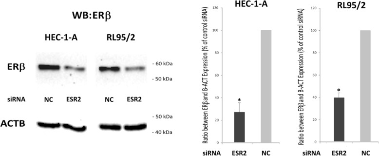 Verification of siRNA-mediated ERβ knockdown in the indicated endometrial cancer cell lines by means of Western blot analysis. Left Panel: Representative Western blot. Right Panel: Diagram showing the mean band intensities from 3 experiments normalized with the housekeeping gene ACTB. The indicated cell lines were transfected either with ESR2 siRNA or negative control (NC) siRNA. *p < 0.01 vs. negative control (n = 3)