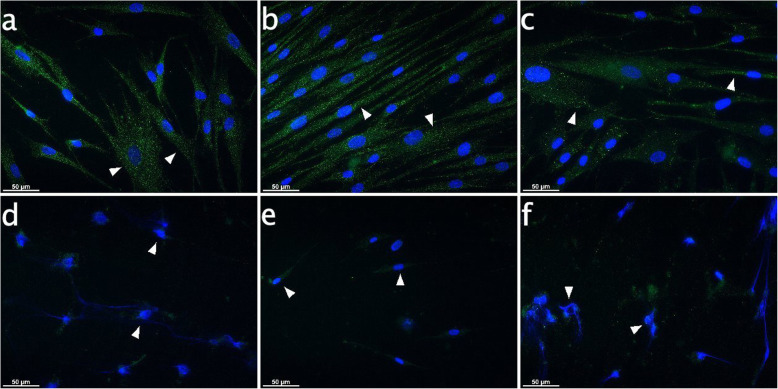 IBA-1 expression in PDL cells subject to CB receptor agonist modulation with or without CII for 10 h. Immunocytochemical analyses for IBA-1 (green) after stimulation for 10 h revealed inherent expression in cultured PDL cells. The IBA-1 signals were distributed equally in the cytoplasm for controls and with endocannabinoid treatment (arrowheads on Fig. a, b, c), exhibiting dotted structures. CII evoked nuclear damage (arrowheads on Fig. d, f), loss of cells and reversal of IBA-1 signals. However, the more intact nuclei were observed in the CIIspecimens additionally treated with AEA. a: Control, b: AEA-treated (50 μM), c: PEA-treated (50 μM), d: 6 h CII, e: 6 h CII plus AEA-treated (50 μM), f: 6 h CII plus PEA-treated (50 μM). Visualization was performed with Alexa 488 (green) secondary antibody. Nuclei were stained with DAPI (blue). Scale bar is 50 μm