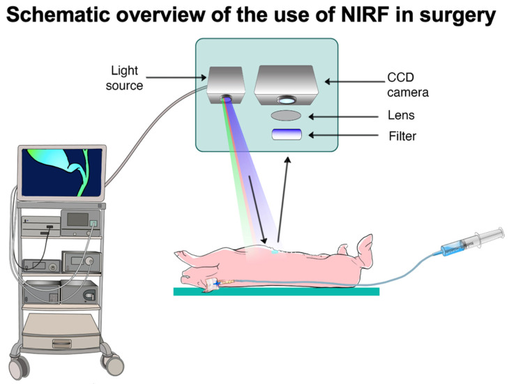 Schematic overview of the use of NIRF in surgery, classical view when using NIR-I imaging system.