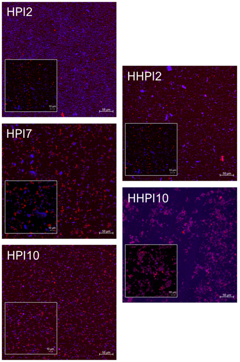 CLSM images of the HPI stabilized o/w emulsions at different pH values before and after heat treatment. Images were acquired at ×20 and ×63 (inlay). Red represents the stained oil phase, while blue represents the stained protein particles.