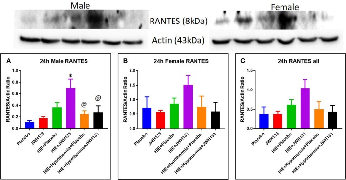 Western blots and densitometry graphs of “regulated on activation normal T cell expressed and secreted” (RANTES) in rat brain 24 h after HI. (A) RANTES levels in male pups at 24 h. (B) RANTES levels in female pups at 24 h. (C) Mean RANTES levels in both male and female pups combined. Actin was used as a loading control. *P < 0.05 vs. placebo; @P < 0.05 vs. HIE + JWH 133.