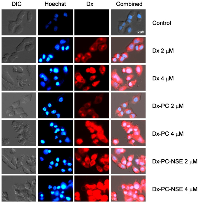 Changes in nucleus ultrastructure and Dx accumulation in HeLa cells under treatment with the indicated concentrations of Dx, Dx-PC, Dx-PC-NSE. Hoechst 33342 staining, fluorescent microscopy, 6 h incubation, ×40.