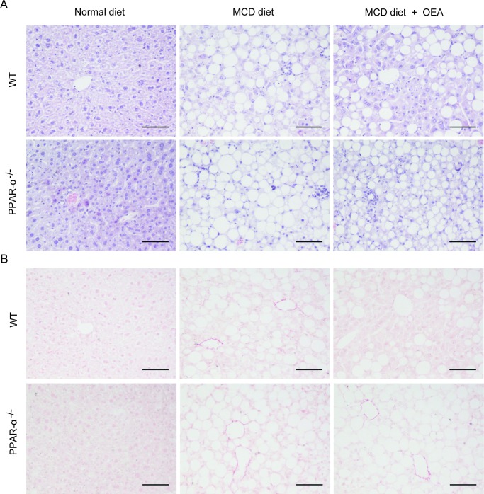 OEA improved liver histology in MCD diet-induced fibrosis mice via PPAR-αA. Hematoxylin-eosin (HE) staining of liver sections in wild-type (WT) mice and PPAR-α knockout mice fed with normal diet, MCD diet, MCD diet combined with OEA administration (5 mg/kg/day, i.p.). B. Sirius red staining of liver sections in wild-type (WT) mice and PPAR-α knockout mice fed with normal diet, MCD diet, MCD diet combined with OEA administration (5 mg/kg/day, i.p.). Scale bars: 100 μm. n = 6-8 in each group.