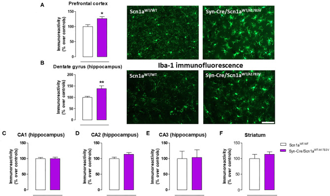 Immunoreactivity for the microglial marker Iba-1 measured by immunofluorescence in different CNS structures, including representative immunofluorescence images in the prefrontal cortex and the hippocampal dentate gyrus, of Syn-Cre/Scn1aWT/A1783V mice compared with Scn1aWT/W animals at PND25. Values are % over controls and correspond to means ± SEM of five to six animals per group. Data were assessed by the Student's t-test (*p < 0.05, **p < 0.01 vs. the control group). Scale bar = 100 μm.