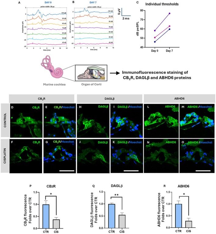 ABR analysis in the in vivo ototoxic model and Immunofluorescence of CB2R, DAGLβ and ABHD6 in the mouse OC upon cisplatin‐induced ototoxicity. (A, B) Representative ABR waveform of the group on day 0 (A) and on day 7 (B). (C) Individual thresholds of 3 animals (each color represents an animal) on day 0 and day 7 shown as symbols with connecting lines between days 0 and 7. (D–G) Representative confocal microscopy images of CB2R (green) counterstained with Hoechst nuclear dye (blue) in control (D, E) and cisplatin‐treated OC (F, G). (H–K) Representative confocal microscopy images of DAGLβ (green) counterstained with Hoechst nuclear dye (blue) in control (H, I) and cisplatin‐treated OC (J, K). (L–O) Representative confocal microscopy images of ABHD6 (green) counterstained with Hoechst nuclear dye (blue) in control (L, M) and cisplatin‐treated OC (N, O). (P–R) Fluorescence intensity of CB2R (P), DAGLβ (Q) and ABHD6 (R) in CTR and CIS‐treated OC, scale bar‐50 μm. Statistical analysis is performed using two‐tailed unpaired student's t‐test (*p < 0.05 vs CTR, **p < 0.01 vs CTR). Data is presented as mean ± SEM (n = 3). Appropriate negative controls for IHC are provided in Figure S42. ABHD6, α/β hydrolase domain‐containing protein; CB2R, cannabinoid receptor 2; CIS, cisplatin; DAGLβ, diacylglycerol lipase β; IF, immunofluorescence.