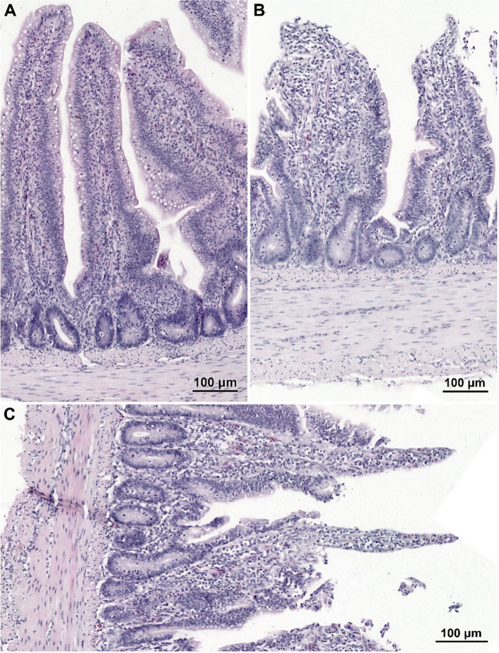 Histological structure of the jejunum in non-infected chicken receiving CBD + nano-Se (A) and birds infected with C. perfringens but not supplemented (with CBD and nano-Se) (B, C). (A) Note well-developed villi covered by a continuous layer of columnar epithelial cells. (B, C) Note the lack of epithelium cover in the apical parts of villi and shortage of villi (B) and abnormal shape of villi (C).