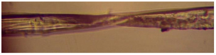 Twist in a technical fiber.