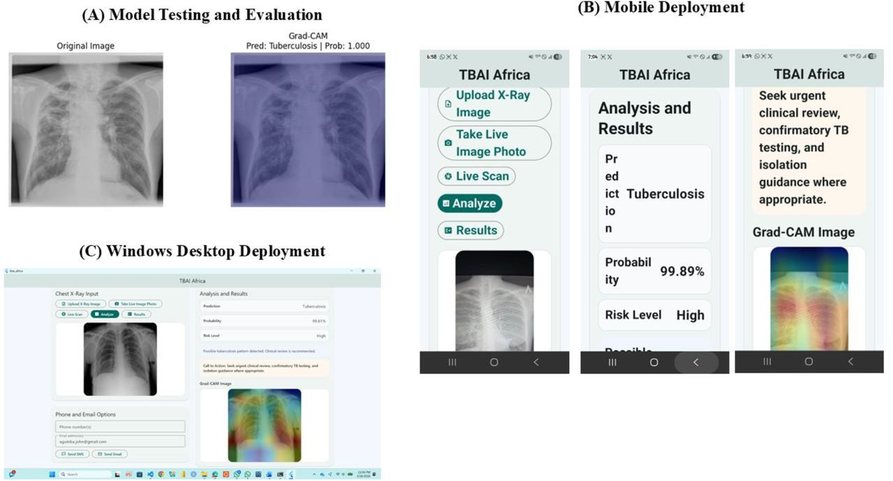 The model testing process and deployment of the tuberculosis screening system across mobile and desktop platforms. Panel (A) shows model testing results with a chest radiograph classified as Tuberculosis and the corresponding Grad-CAM visualization highlighting relevant lung regions. Panel (B) shows the mobile deployment with TensorFlow Lite integration for image upload, prediction, and Grad-CAM visualization. Panel (C) shows the Windows desktop deployment with prediction results, probability scores, risk assessment, and Grad-CAM visualization, demonstrating consistent performance and explainability across platforms.