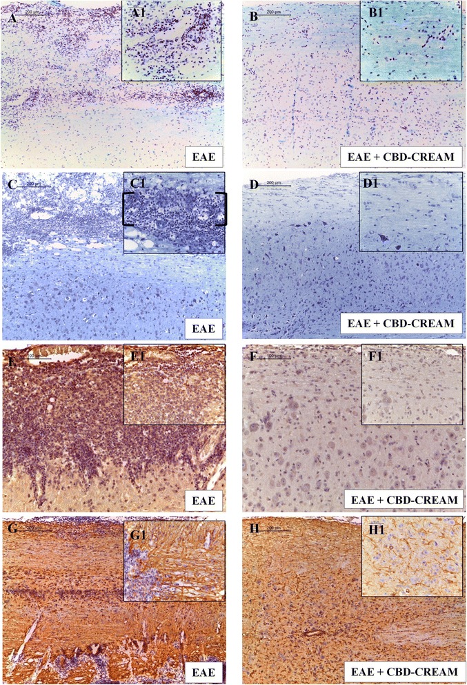 LFB staining compared EAE group (a:10x, A1 magnification:40x) to EAE+ 1 % CBD-cream (b:10x, B1 magnification:40x). May-Grunwald Giemsa staining for EAE mice (c:10x, C1 magnification:40x) compared to mice treated with 1 % CBD-cream (d:10x, D1 magnification:40x). Immunohistochemical evaluation for Foxp3 in EAE (e:20x, E1 magnification:40x) and in EAE + 1 % CBD-cream mice (f:20x, F1 magnification:40x). Immunohistochemical evaluation for GFAP in EAE (g:10x, G1 magnification:40x) and in EAE + 1 % CBD-cream mice (h:10x, H1 magnification:40x)