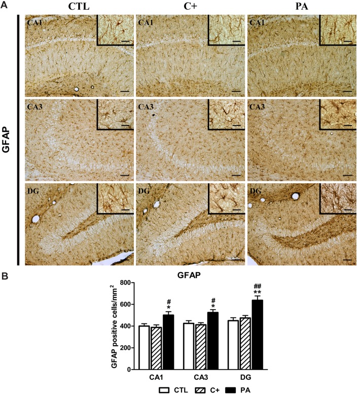 Glial fibrillary acidic protein (GFAP) immunostaining in dorsal hippocampus. (A) Representative photomicrographs showing GFAP-positive cells in CA1, CA3, and DG regions of the dorsal hippocampus in the different experimental groups. Scale bars = 15 and 3 μm in insets. (B) Quantification of the number of GFAP-positive cells in CA1, CA3, and DG regions of the dorsal hippocampus in the different experimental groups. Bars and error bars show the mean + SEM of 5–7 observations per animal of a total of six rats per group. ∗p < 0.05 vs. CTL; ∗∗p < 0.01 vs. CTL; #p < 0.05 vs. C+; ##p < 0.01 vs. C+. CTL, control group; C+, cesarean section group; PA, perinatal asphyxia group; CA1, cornu ammonis 1; CA3, cornu ammonis 3; DG, dentate gyrus.