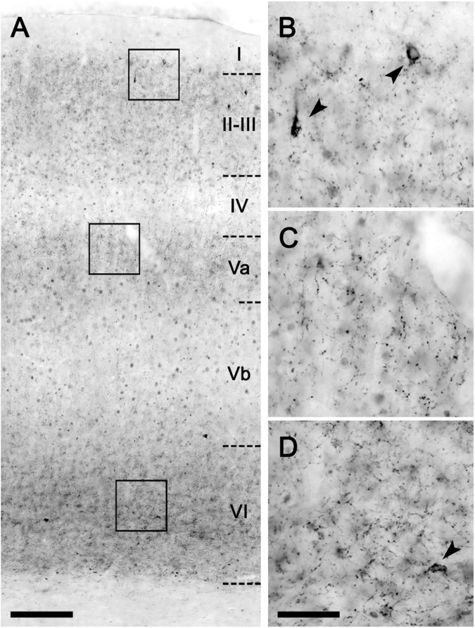 CB1-immunohistochemical staining pattern in the neocortex of the lean Zucker rat. (A) Low magnification micrograph of the primary motor neocortical area showing the layer distribution of CB1-immunostaining. (B–D) Higher magnification images of areas framed in A to illustrate the immunostaining pattern in layers II (B), Va (C), and VI (D). Arrowheads indicate CB1-immunopositive interneurons. Scale bars = 100 μm in (A); 25 μm in (D) (applies to B–D).