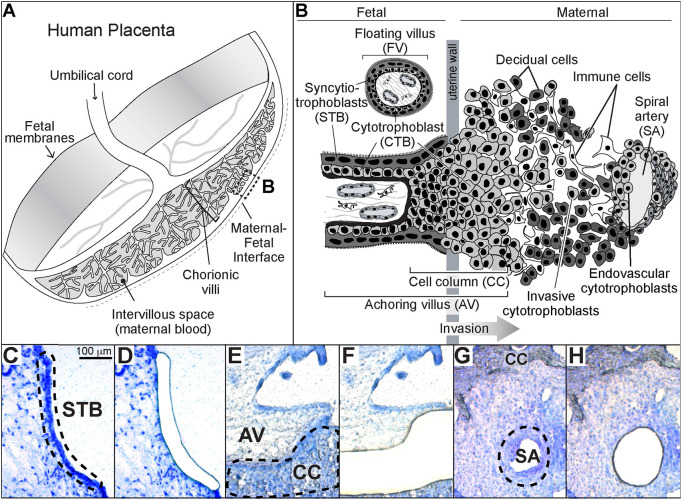 Human placenta trophoblast subtypes targeted for laser microdissection. (A) Diagram of the human placenta in the second trimester of pregnancy. The boxed area (B) indicates the region biopsied for these studies. (B) View of the maternal-fetal interface at the cellular level. Shown are the two classes of chorionic villi. Floating villi (FV), which are covered by multinucleated syncytiotrophoblasts (STB), transport substances between the mother and the embryo/fetus while producing growth factors and hormones essential to the unique symbiosis of pregnancy. Anchoring villi (AV), contain mononuclear cytotrophoblast progenitors that either fuse to form STBs or exit the placenta proper through cell columns (CCs) that attach the embryo/fetus to the uterus. Endovascular cytotrophoblasts mediate an increase in the terminal diameter of the maternal spiral arteries, enabling increased blood flow to the placenta. The arrow indicates the direction of trophoblast invasion (modified from Damsky et al., 1994). (C-G) Photomicrographs taken before and after STB, CTB and ENDO were isolated using LMD. The sections were stained with Toluidine Blue, which enabled visualization of the cellular architecture. The dotted lines indicate the three trophoblast-containing regions that were targeted. SA, spiral artery.