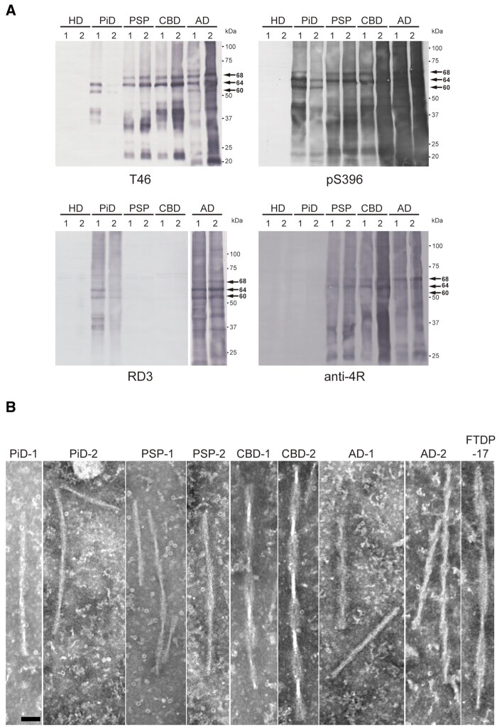 Biochemical and ultrastructural characterization of abnormal tau extracted from human tauopathies. (A) Immunoblot analyses of sarkosyl-insoluble fractions prepared from brains of tauopathy and Huntington’s disease patients. Sarkosyl-insoluble full-length tau (60, 64 and 68 kDa) and CTFs were detected with T46 (top left) and pS396 (top right) antibodies. 3R tau and 4R tau were detected with RD3 (bottom left) and anti-4R (bottom left) antibodies, respectively. Full-length blots are presented in the Supplementary material. (B) Electron microscopy of sarkosyl-insoluble fractions extracted from PiD, PSP, CBD, Alzheimer’s disease and FTDP-17T cases. Scale bar = 50 nm.