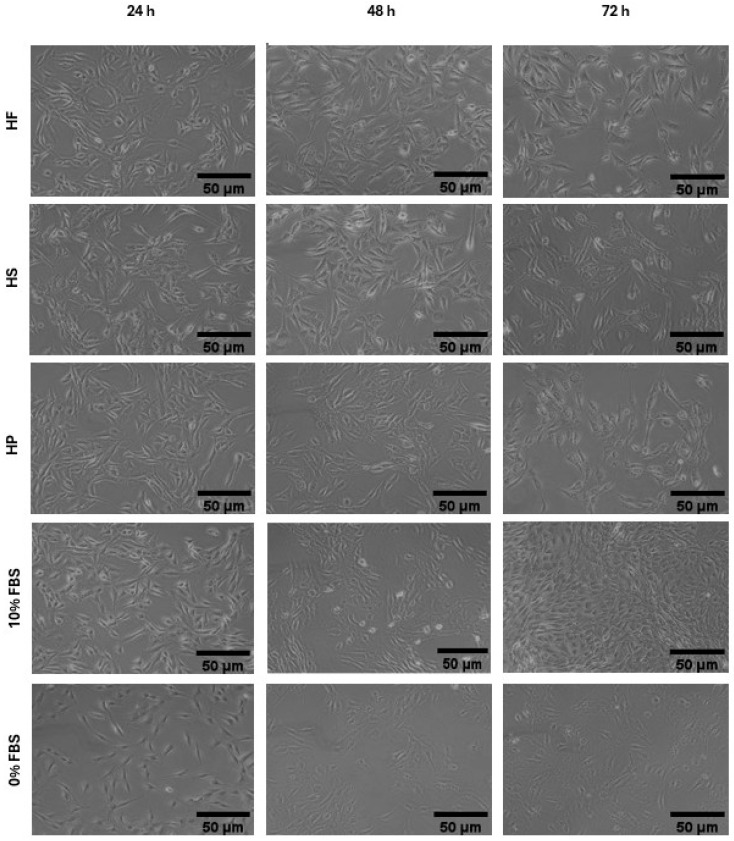 Morphology of C2C12 cells cultured in media supplemented with 11.7 mg/mL of HF (hemp flower), HS (hempseed), HP (hempseed protein) hydrolysates, 10% FBS (fetal bovine serum) and 0% FBS after 24 and 48 and 72 h. Images were acquired at 10× magnification.